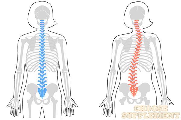 how-does-scoliosis-affect-height